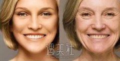 唐山像素射频除皱一般多少钱?费用多少合理呢? width=