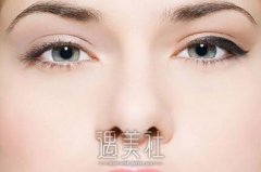 膨体隆鼻恢复时间一般是多久？如何护理利于恢复？ width=