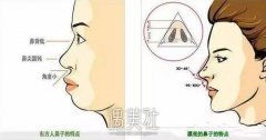 东莞固体硅胶隆鼻大概多少钱?小编来告诉你! width=