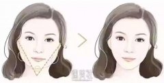 西安注射瘦脸哪家医院好?有没有特别推荐的机构? width=