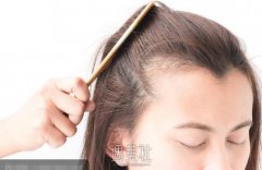 嘉兴发际线修复手术价格一般多少?小项目不会很贵吧? width=
