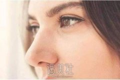 假体隆鼻恢复时间大约是多久呢？如何更好恢复？ width=