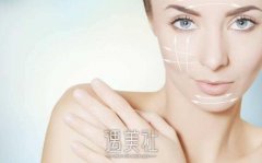 面部吸脂和去颊脂垫究竟哪个好喃？小葵这就告诉你！ width=