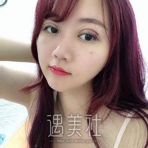 双眼皮全切图片