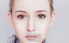 高分子埋线双眼皮恢复时间一般是多长？国庆想去做！ width=