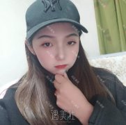 北京协和医院整形科宋可新双眼皮案例：现在的眼睛水汪汪的~ width=