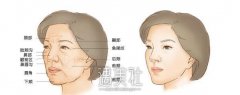 面部填充术前要抽血检查吗?面部填充术前注意事项～ width=