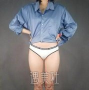 郑州丽天整形医院吸脂怎么样?吸脂真实案例硬核展示～ width=