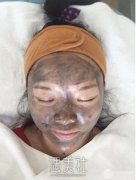 黑脸娃娃功图片分享|黑脸娃娃真实案例悄悄分享给你～ width=
