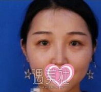 广州紫馨谷琪祛眼袋技术好吗？有真实案例吗？ width=