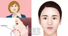双鄂手术和正颌手术的区别是什么?跟着小编一起来了解～ width=