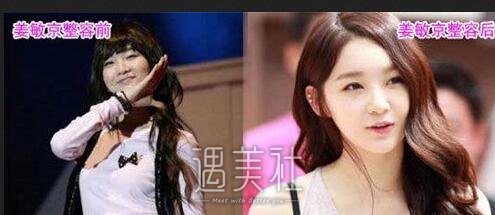 姜敏京整容前后
