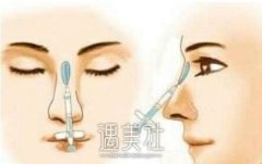 芜湖伊凡露注射隆鼻价格大概要多少?准备多少预算合适? width=