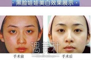 黑脸娃娃