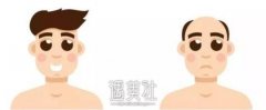 发际线修复靠谱吗?发际线修复一般能保持多久喃? width=