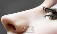 南宁鼻翼改薄整形要多少钱?跟着小编一起来了解下哇! width=