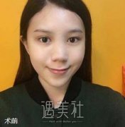 自从做了蒜头鼻矫正整形术，满满的自信心油然而生呐～ width=