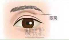 玻尿酸眼窝填充需要几只？玻尿酸眼窝填充只需做一次吗？ width=