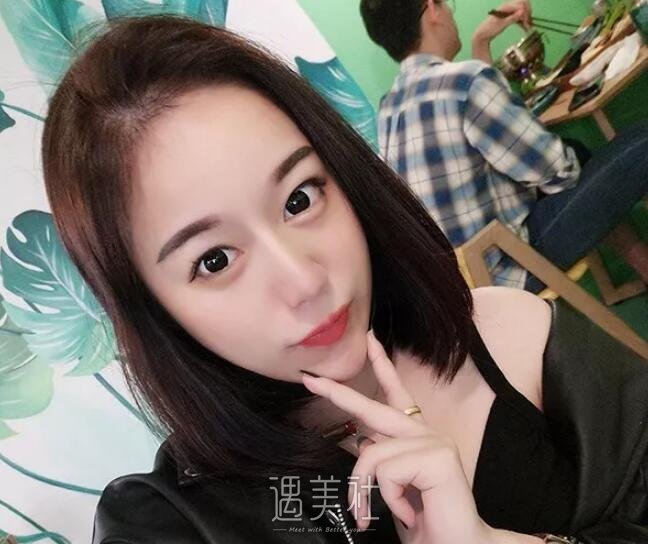 九院王炜隆鼻真实案例分享~前后变化确实很大!