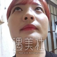 九院韦敏颧骨下垂矫正案例，终于能回归状态了!