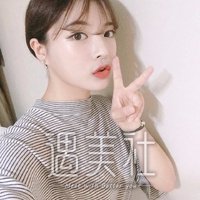 九院韦敏颧骨下垂矫正案例，终于能回归状态了!