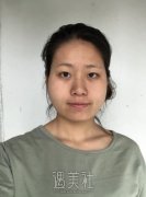 上海面部吸脂塑形大概多少钱?脸上脂肪太多想塑形喃! width=