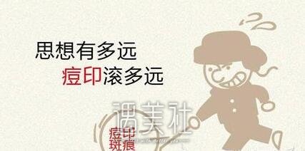 像素激光除痘印