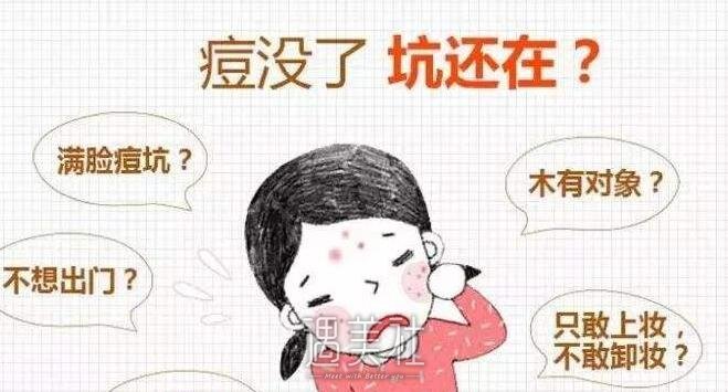 像素激光除痘印