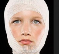 北京做磨腮削骨多少钱？大概准备多少预算比较合适？ width=