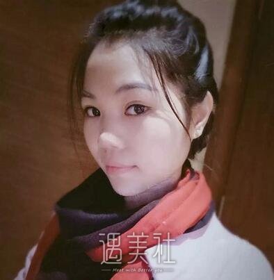 周一雄,双眼皮