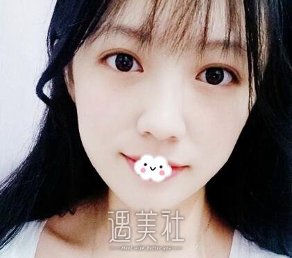 赵耀忠,双眼皮
