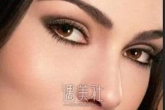 焦作高分子双眼皮价格要花多少钱?有哪些影响因素喃? width=