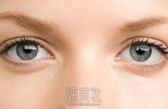 张姣姣和解灿做双眼皮哪个好点？技术亮点和资质火热PK~ width=