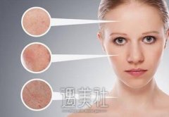 昆山像素激光美容价格大约是多少?我在网路上查到这些~ width=