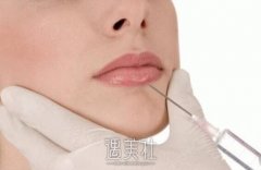 上海玻尿酸丰唇改唇价格一般是多少?干瘪的嘴唇不好看~ width=