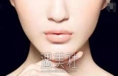 成都垫下巴大概多少钱：是什么决定了市场价？ width=