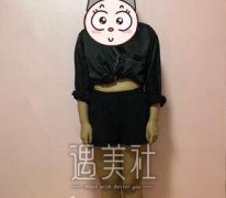 北京吸脂技术哪家好？协和医院吸脂案例+果图一览 width=