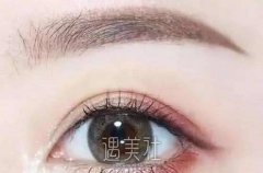 眼窝填充和双眼皮可以同时做吗，有什么注意事项？ width=