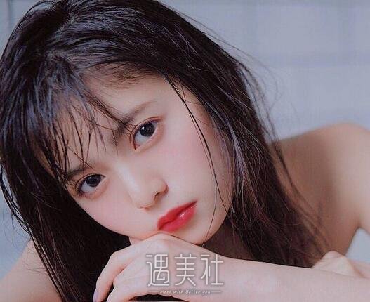 面颊填充术
