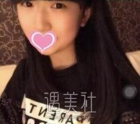 郑州悦美整形美容医院做了开眼角，水灵灵的大眼睛很稀罕~ width=