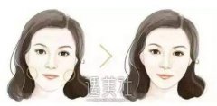 磨腮削骨手术是什么原理?磨腮削骨有什么后遗症呢? width=