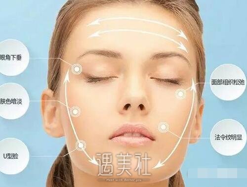 面部提升术