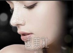 珠海垫个鼻梁大概要多少钱？每个城市收费情况都不一样吧？ width=