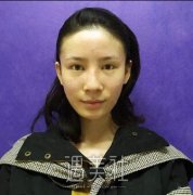 沈莺莺做双眼皮修复怎么样|沈莺莺双眼皮修复案例登陆~ width=