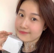 面部吸脂果对比照片|面部吸脂近期一则真实案例登陆啦~ width=