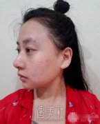 名流整形医院做了皮肤美白，何时何地的我都是美美哒~ width=