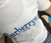 乔爱军自体脂肪移植丰胸案例：终于有勇气昂首挺胸做人~ width=