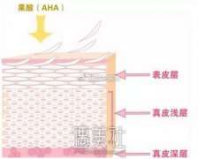 果酸换肤的果如何?果酸换肤果大概能维持多久喃? width=