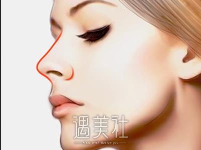 硅胶垫鼻梁