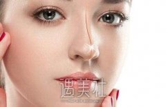 廊坊打胶原蛋白隆鼻大概多少钱？想隆鼻的盆友可以了解下~ width=